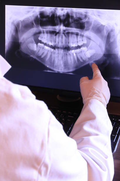 Best Emergency Wisdom Teeth Removal in Scottsville, KY
