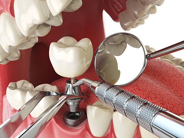 Best Emergency Dental Care for Trauma or Injury in Scottsville, KY